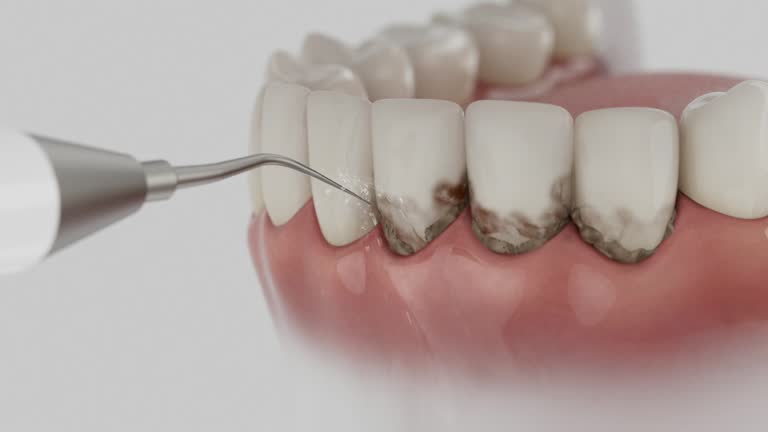 Trusted Wisdom Tooth Removal service in Tioga, TX - Dentist Open Now